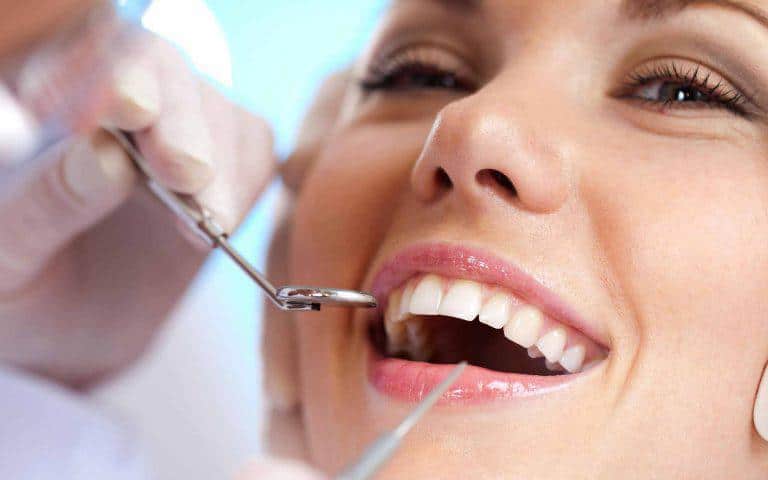 Teeth Bonding: What to Expect