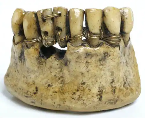 Ancient dentures