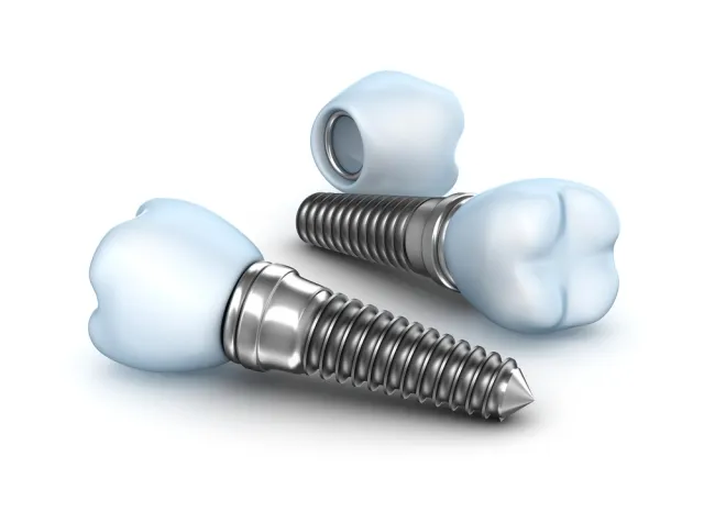 Dental Implants, Titanium