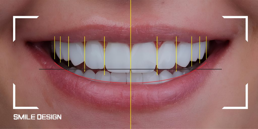 Aesthetic Dentistry Vs Cosmetic Dentistry