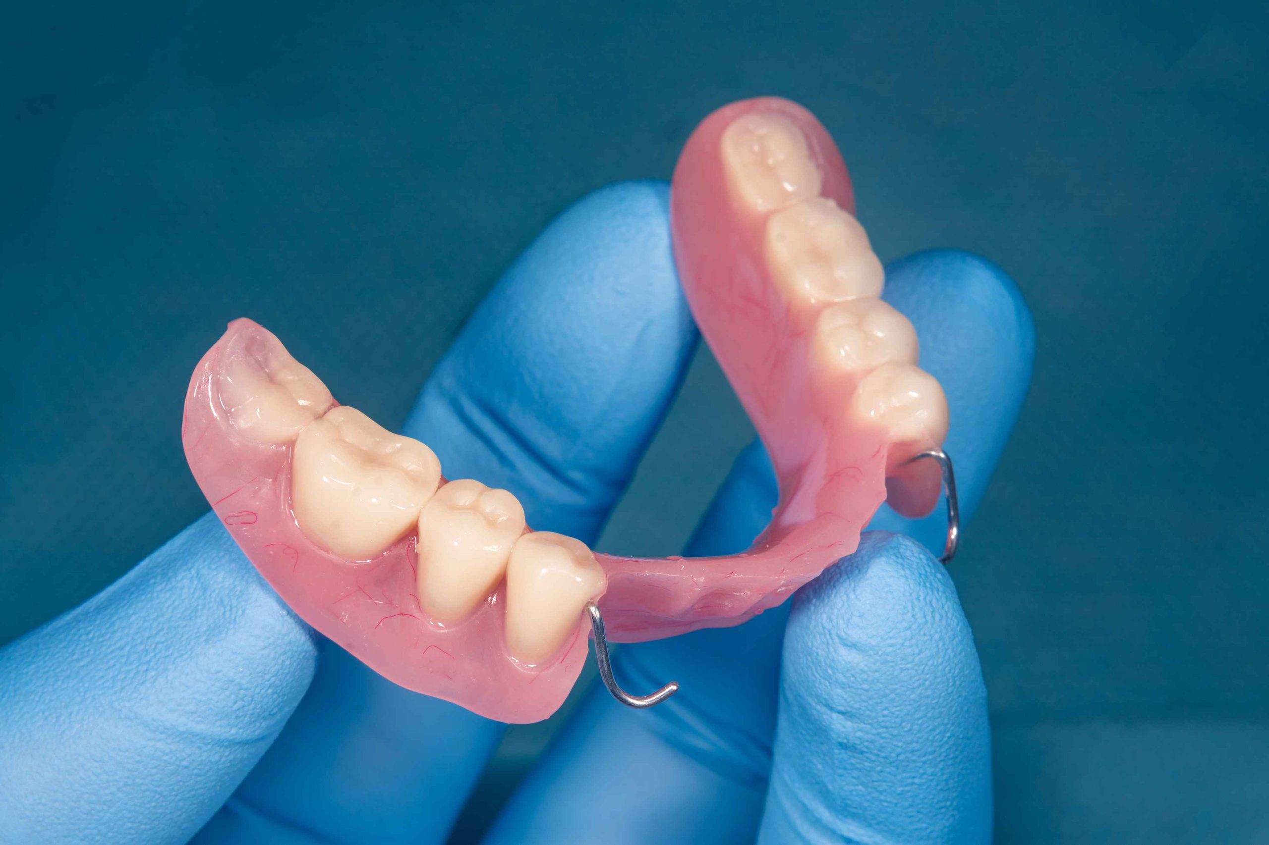 dental implants and dentures