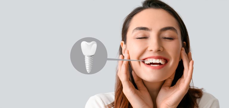 Care for Your Dental Implants