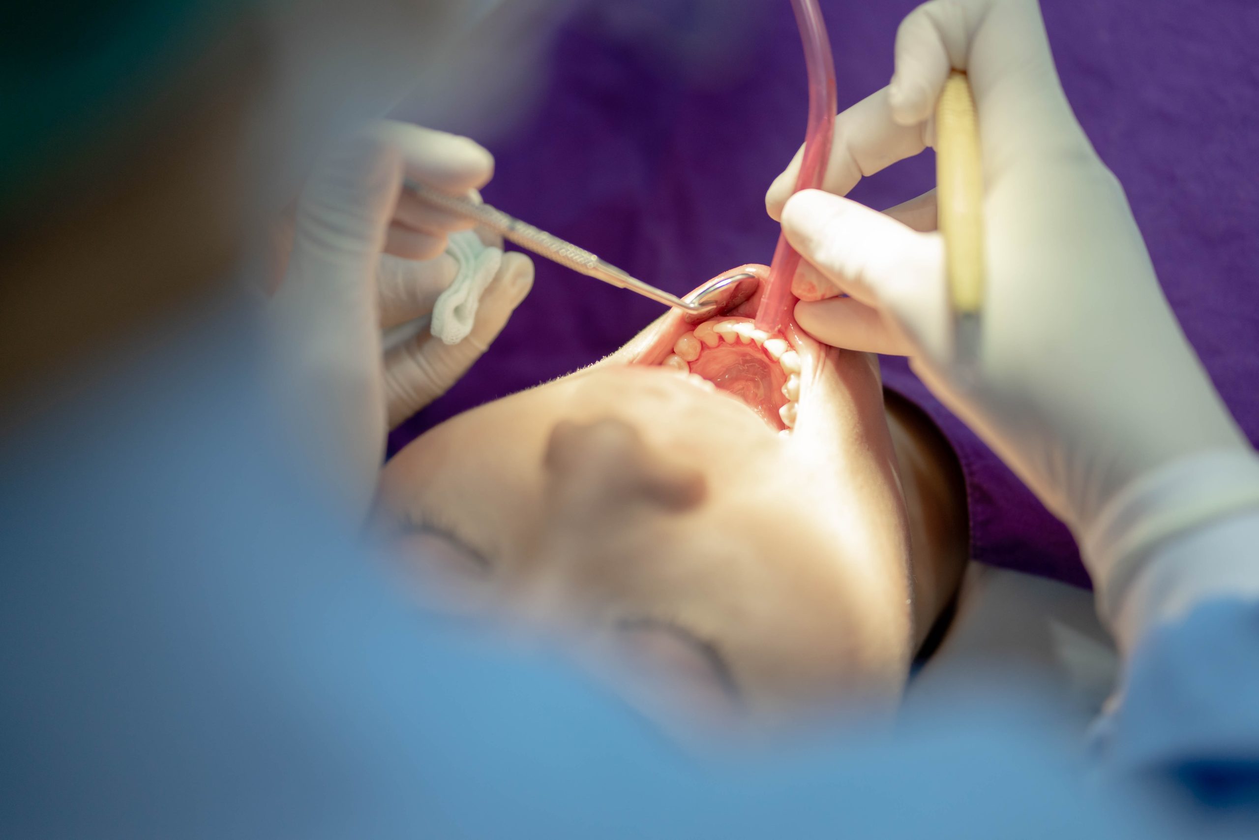 emergency dental care in Colorado