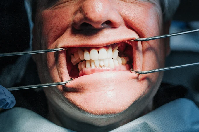 Affordable Dentures Colorado - DIC Colorado