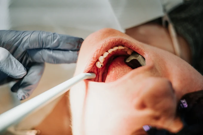 Emergency Dentist in Westminster - DIC Colorado