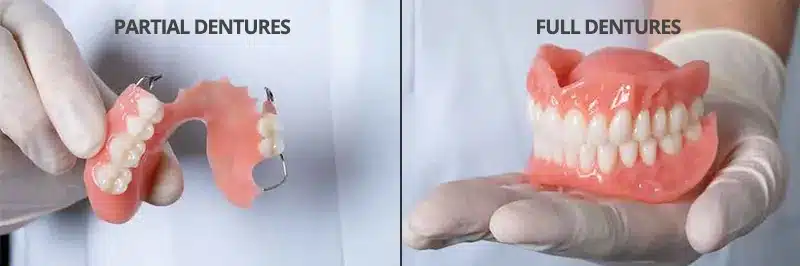 Full Dentures vs Partial Dentures - DIC Colorado